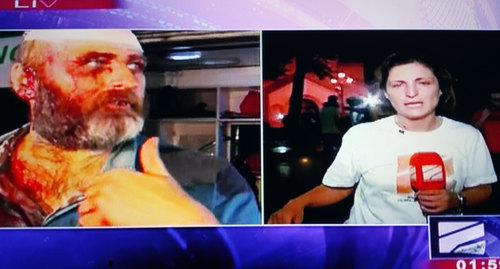 Раненый Беслан Кмузов дает интервью журналистам. Фрагмент выпуска новостей. . Фото Инны Кукуджановой для "Кавказского узла"