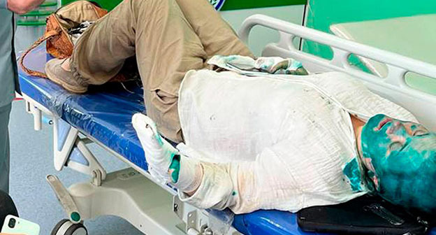 Елена Милашина после нападения. Фото: Телеграм-Канал no_torture

