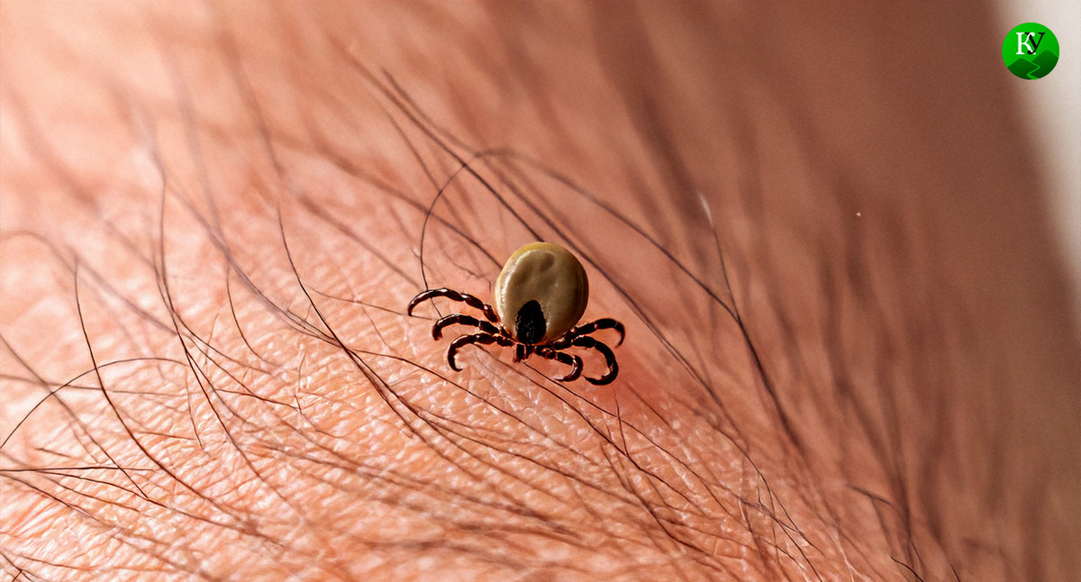 Клещ. Иллюстрация создана «Кавказским узлом» с помощью ИИ в программе Copilot